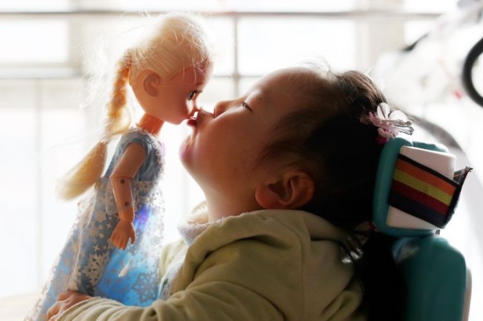 Criança diagnosticada com atrofia muscular espinhal (AME) - (Foto: ChinaImages/Depositphotos)