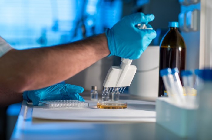 Com a nova alta do número de casos, há relatos de aumentos excessivos nos valores cobrados para testes de covid-19 - Unlisted / Stock Photos