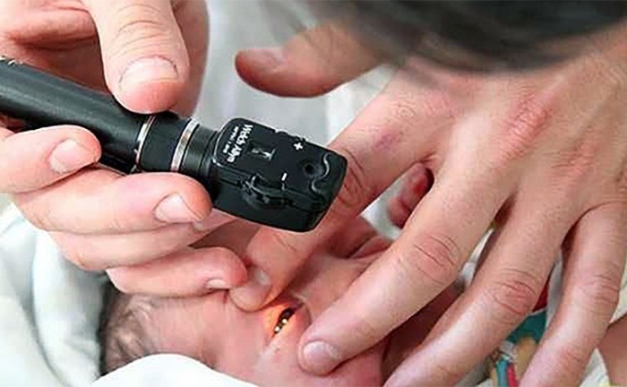 Secretaria da Saúde alerta sobre importância do “Teste do Olhinho” para bebês