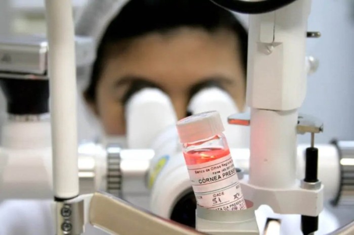 Banco de Olhos do Hospital Universitário da UEL chega a 2 mil doações