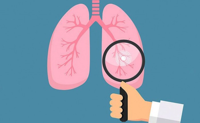 Secretaria da Saúde do Tocantins alerta para a prevenção da tuberculose durante o mês de março