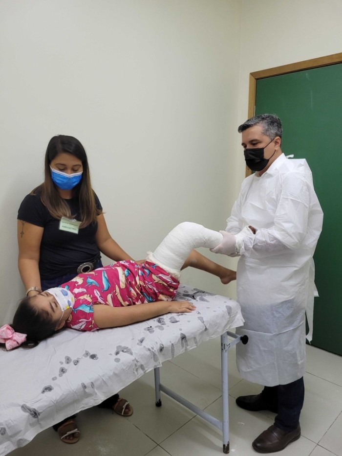 Hospital Infantil é referência no tratamento de pé torto congênito