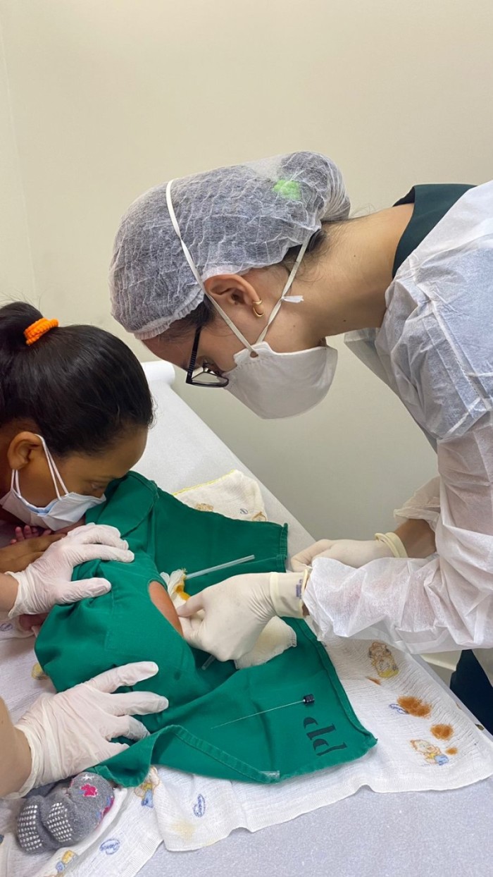 Hospital Infantil realiza aplicação de spinraza em bebê assintomático com AME
