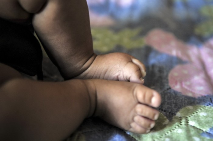 Covid-19 mata duas crianças menores de 5 anos por dia no Brasil