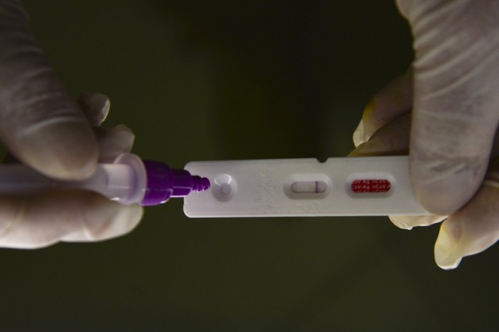Brasil registra 18,5 mil novos casos e 53 mortes por covid-19
