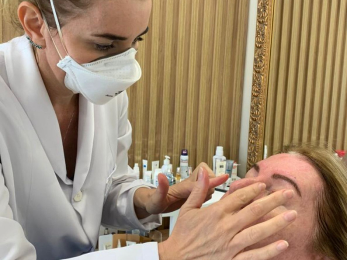 Pesquisa aponta que a menopausa leva a alterações cutâneas