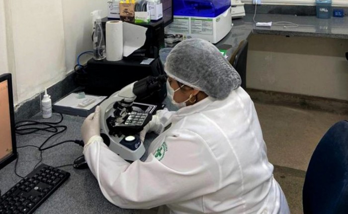 Governo do Tocantins amplia serviços laboratoriais dos hospitais estaduais