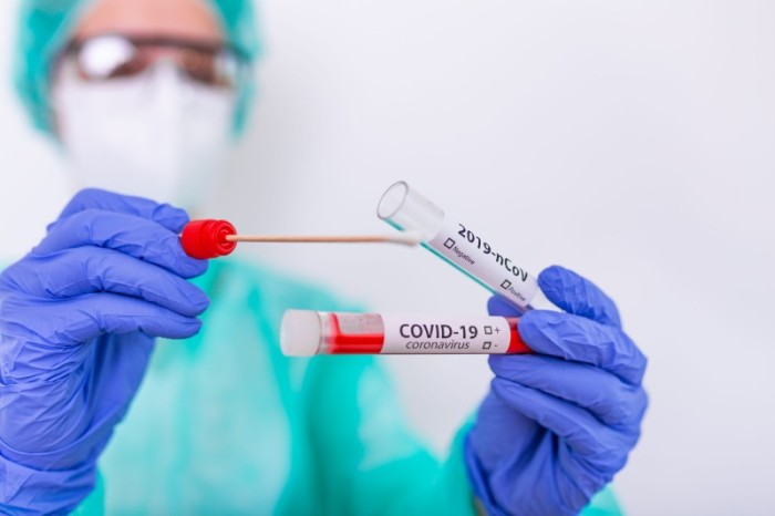 CIEVS conclui investigação de óbitos por Covid-19 em 2021 e 2022
