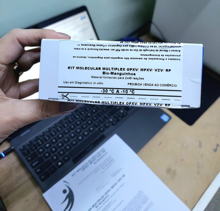 Lacen começa a realizar exames para detectar a Mpox