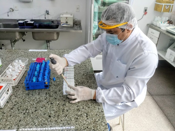 Casos e óbitos por Covid-19 permanecem em queda no Piauí