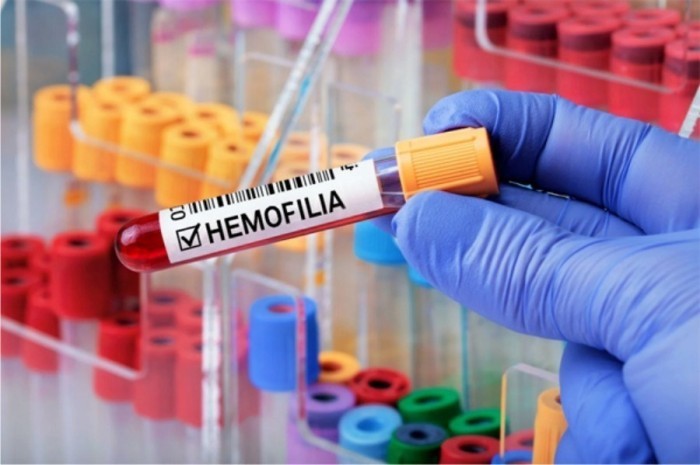 Hemocentro de Vitória é referência em tratamento a hemofílicos