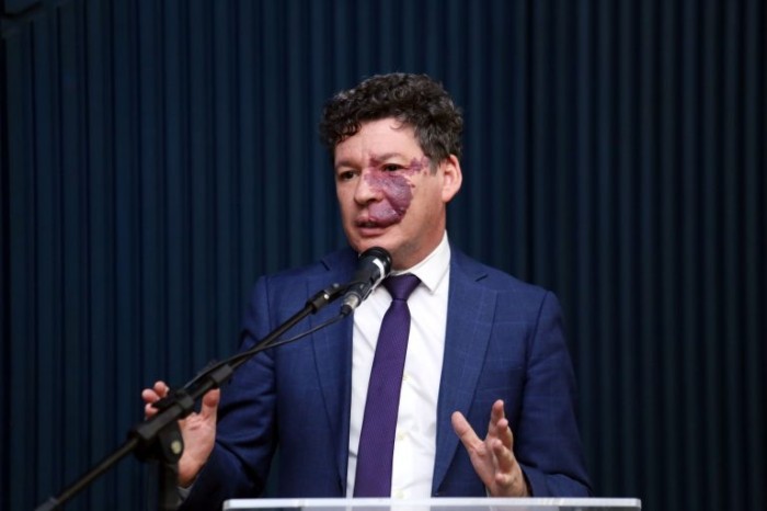 Reginaldo Lopes: o novo imposto poderá ter uma versão federal e outra subnacional - (Foto: Billy Boss/Câmara dos Deputados)