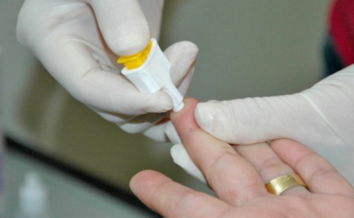 Governo do Tocantins reforça alerta para riscos das hepatites virais