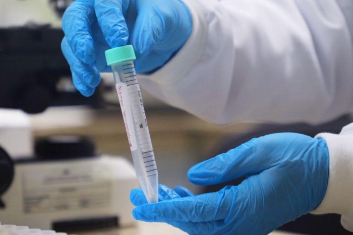 Mpox: Informe epidemiológico mensal atualiza situação da doença no Amazonas
