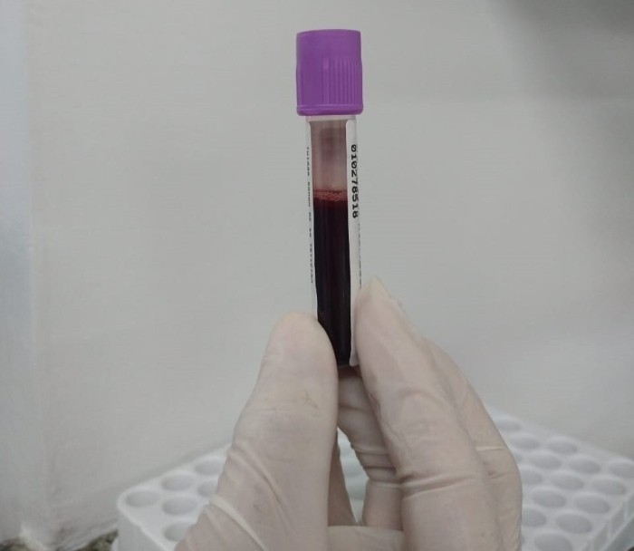 Foto: Reprodução/Secom Piauí