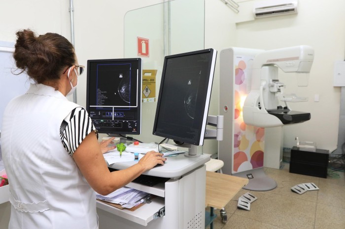 Nova logística e carga horária maior agilizam exames de mamografia