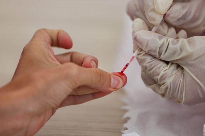 Unidades de Saúde da Família de Palmas terão dia D voltado para saúde da mulher