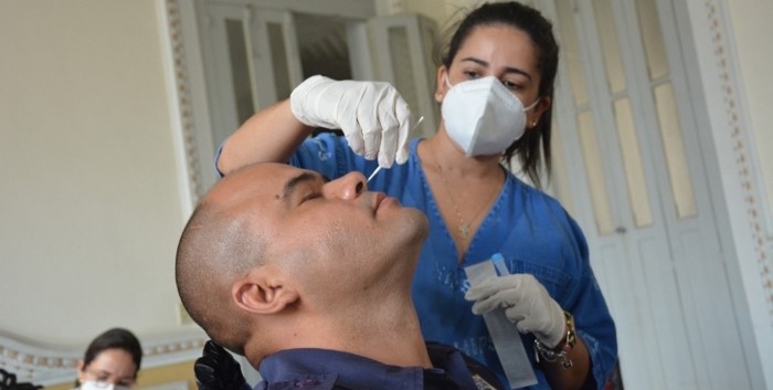 De forma temporária, apenas RT-PCR será realizado para diagnóstico da covid