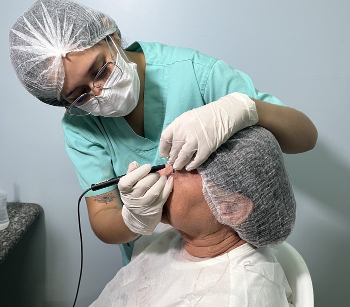 Opera Paraíba atende mais 230 paraibanos com cirurgias de catarata em Taperoá