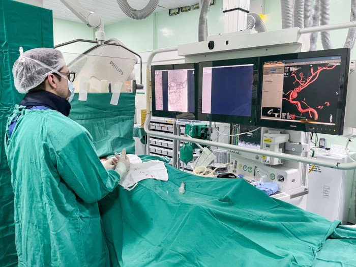 Trombectomia mecânica: como o HGF se tornou protagonista na implantação do procedimento no SUS