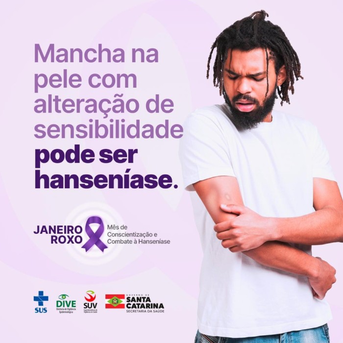Janeiro Roxo: data alerta sobre diagnóstico precoce e tratamento adequado da hanseníase