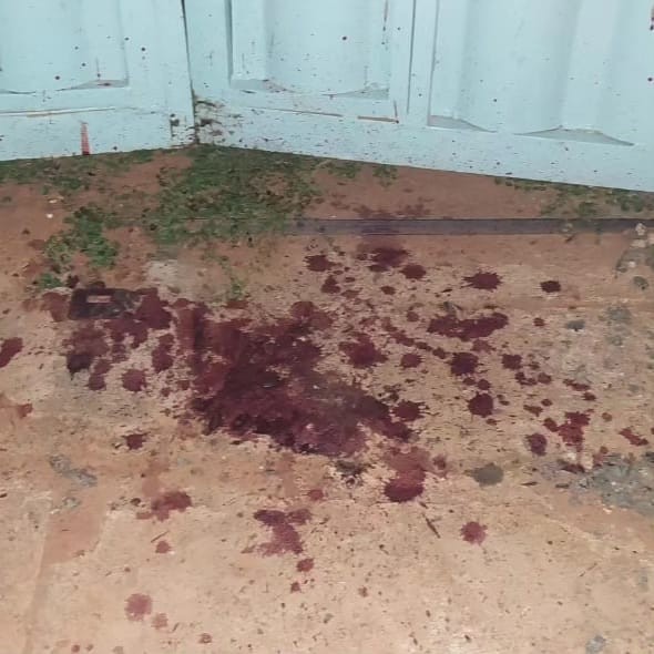 Polícia Civil prende homem por lesão corporal grave em Rio Negro