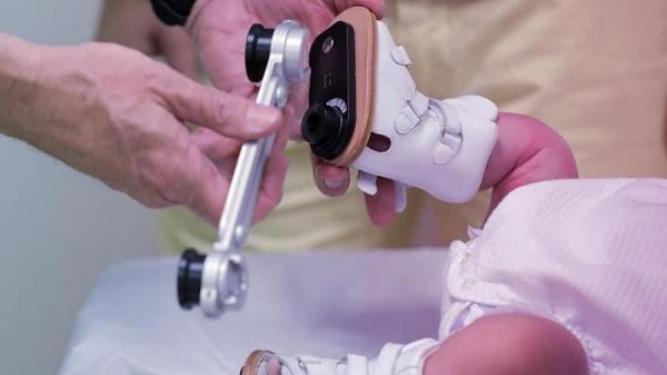 Vereador pede a adoção da Técnica Ponseti para tratamento do pé torto congênito pelo SUS