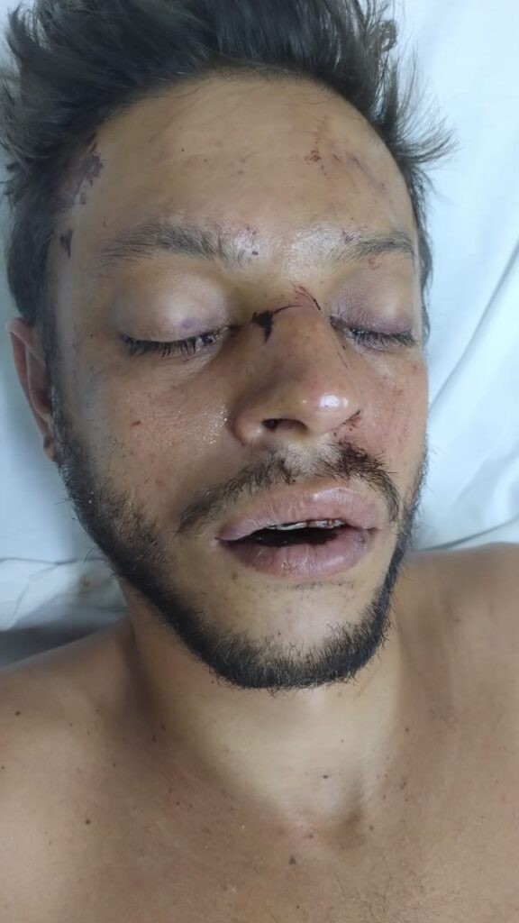 SES-AM pede ajuda para encontrar familiares de paciente internado no HPS João Lúcio