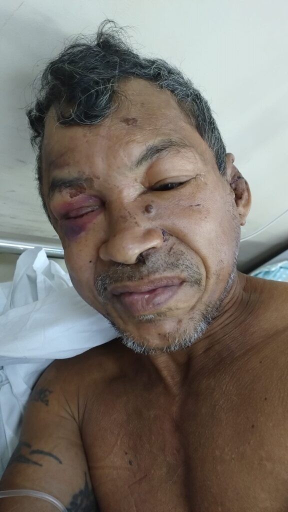 Hospital João Lúcio pede ajuda para encontrar familiares de paciente internado