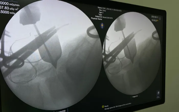 Hospital Justino Luz em Picos realiza primeira cirurgia de coluna por vídeo