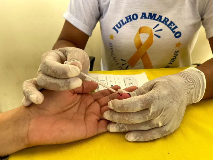 Julho Amarelo: CTA/SAE promove campanha de conscientização e testagem contra as Hepatites Virais