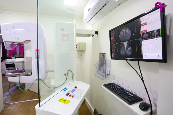 Imagens capturadas nos mamógrafos são encaminhadas para o Serviço Estadual de Diagnóstico por Imagem (SEDI) da Secretaria de Estado da Saúde