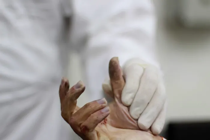 De janeiro a setembro deste ano, método por impressão digital de cadáver do IML e IIACM auxiliou na identificação de 420 corpos