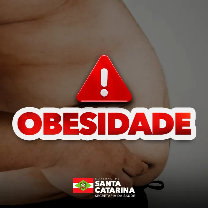 Dia Nacional da Obesidade: Secretaria da Saúde reforça conscientização e rede de atendimento em SC