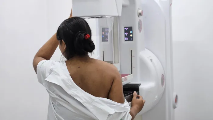 - Governo do Maranhão reforça diagnóstico do câncer de mama com novo mamógrafo em Caxias (Foto: Divulgação)