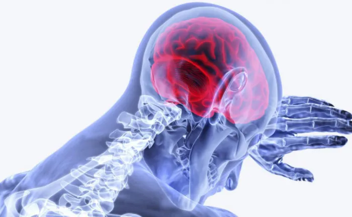 SES-TO alerta para os tipos, sintomas e prevenção contra o AVC