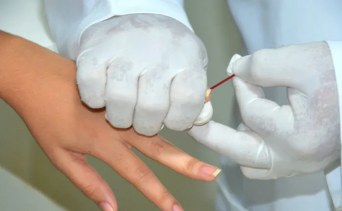 No Dezembro Vermelho, SES-TO destaca a importância da prevenção do HIV/Aids e outras Infecções Sexualmente Transmissíveis