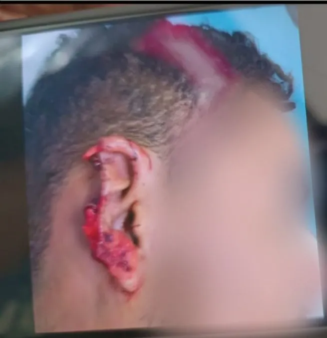 Foto: Reprodução/Prefeitura de São Sebastião - SP