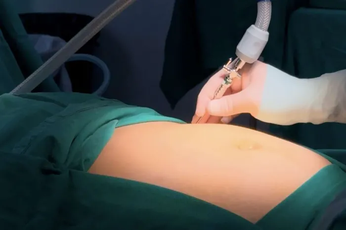HGF dá início ao Programa de Cirurgia Bariátrica e inaugura Salas Inteligentes