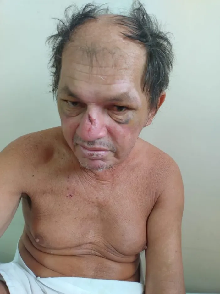 HPS João Lúcio pede ajuda para localizar familiares de paciente vítima de atropelamento