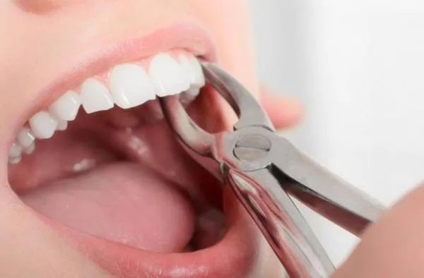 Foto: Reprodução/Prefeitura de Sorriso - MT