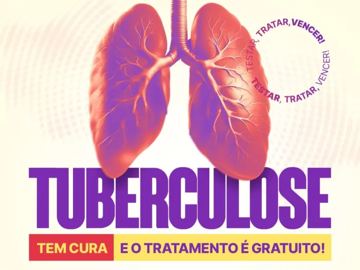 Foto: Reprodução/Secom SC