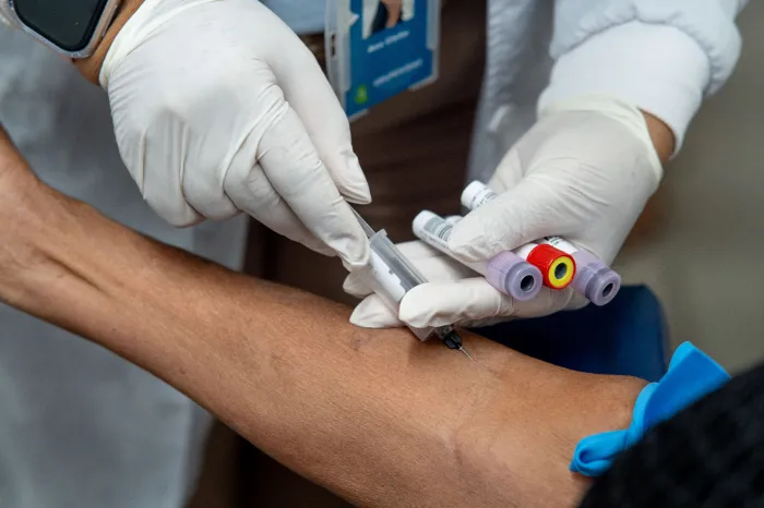 Sesau inicia coleta descentralizada de exames laboratoriais no município