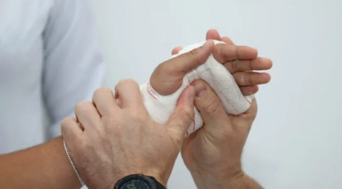 Traumas causados por acidentes com motocicletas são uma das principais causas de internação no Huse