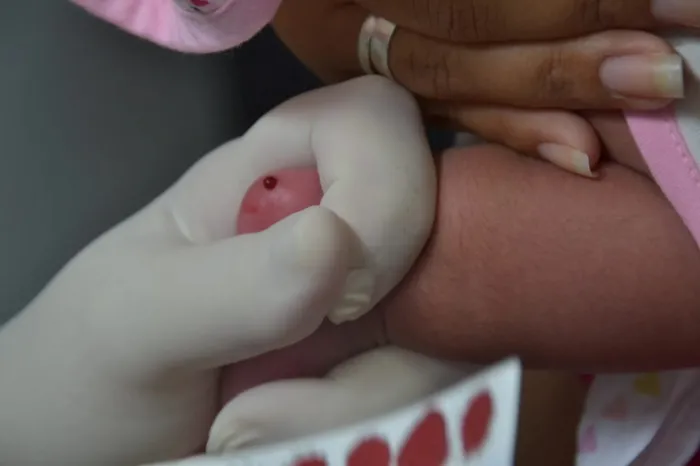 Instituto Cândida Vargas reforça a importância do teste do pezinho para a saúde do bebê
