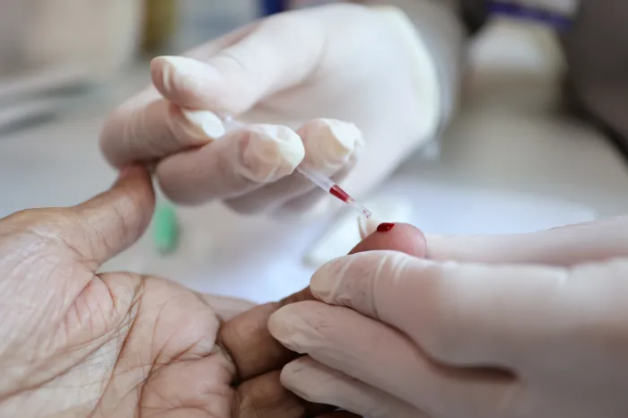 Prefeitura reforça ações de prevenção e diagnóstico das hepatites virais