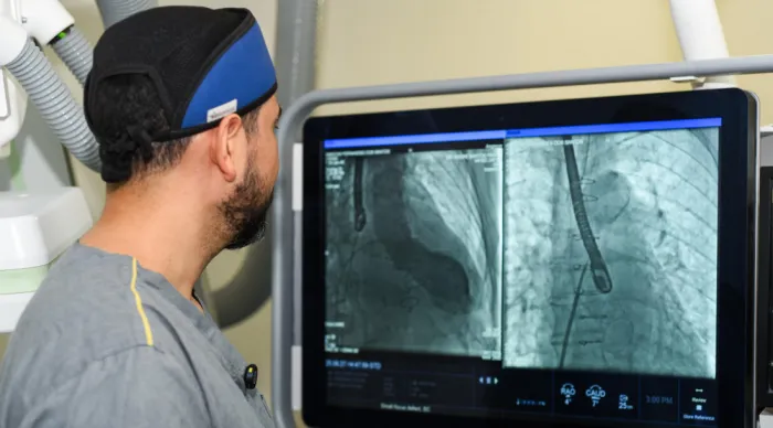 Sergipe realiza procedimentos cardíacos inéditos por meio do Sistema Único de Saúde