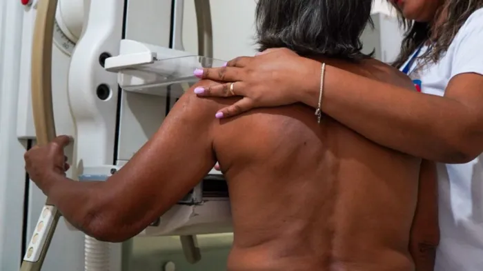 Secretaria de Saúde de Araçatuba realizou mais de 760 mamografias e 2 mil preventivos durante campanha Outubro Rosa
