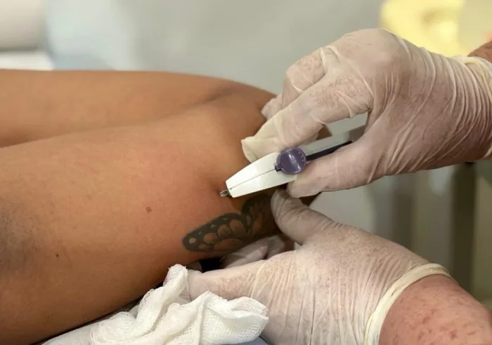 Prefeitura de Rio Branco amplia acesso ao Implanon e capacita profissionais na URAP Roney Meireles