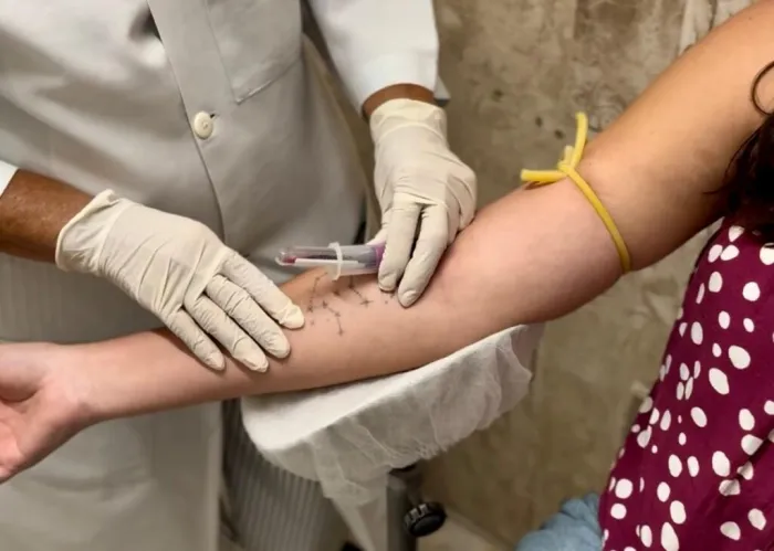 Hemope celebra Semana de Mobilização Nacional para Doação de Medula Óssea